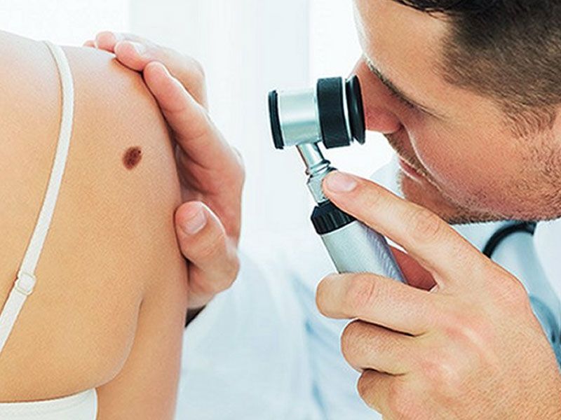 Najava: Besplatni pregled madeža u ambulanti Dražice